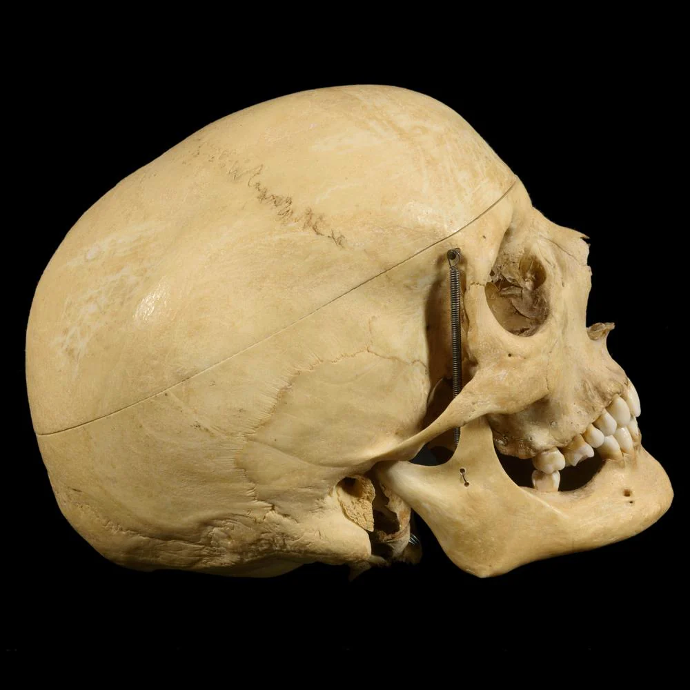 Miniature 5
